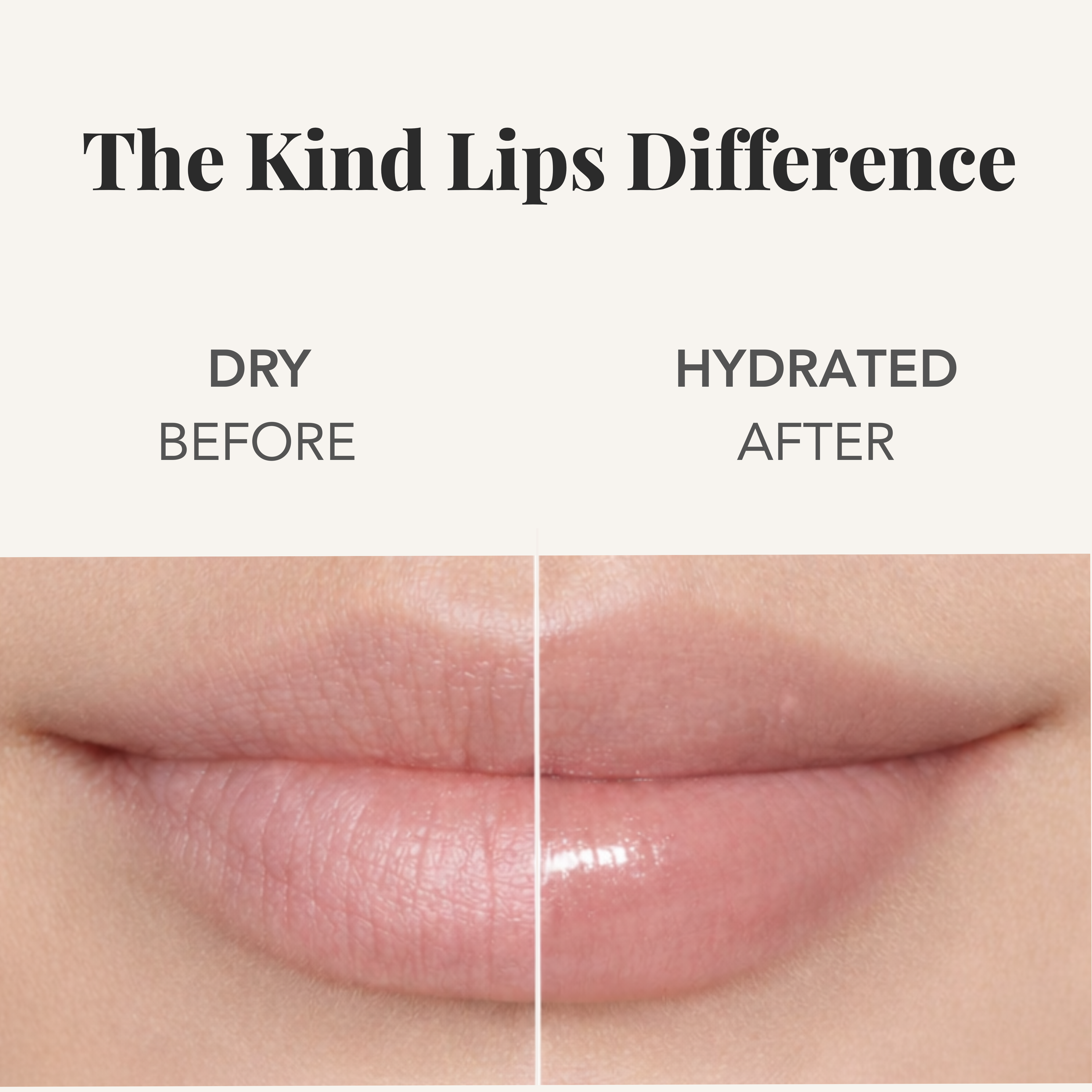 Kind Lips Organic Lip Balm Vanilla Lemon | Petroleum Free | Gluten Free | Made in USA